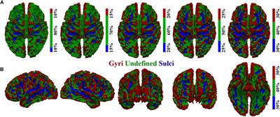 Temporal Variability of Cortical Gyral-Sulcal Resting State Functional Activity Correlates With Fluid Intelligence